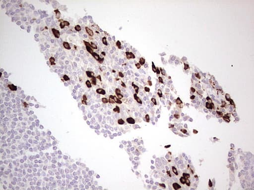 LAMB3 / Laminin Beta 3 Antibody (aa22-315, clone OTI1H10)