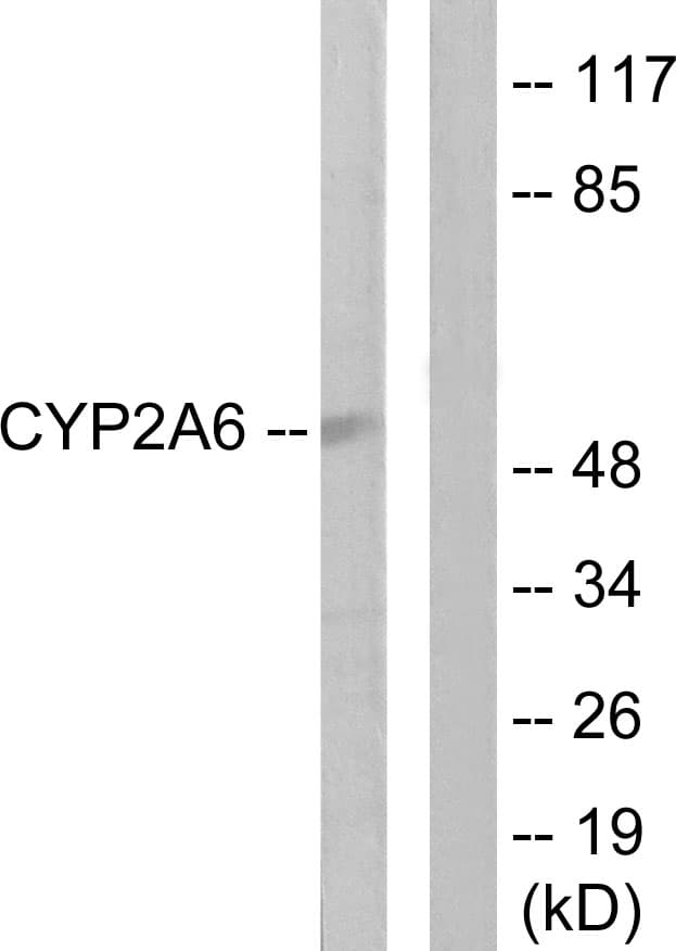 CYP2A6 Antibody (aa1-50)
