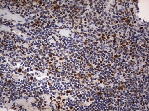 PARN Antibody (aa1-266, clone UMAB143, Carrier-free)