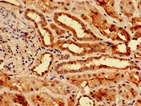 Polyclonal Rabbit anti-Human SLC25A1 / SEA Antibody (IHC, IF)