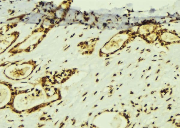 Polyclonal Rabbit anti-Human TAF5 Antibody (IHC, IF, WB)