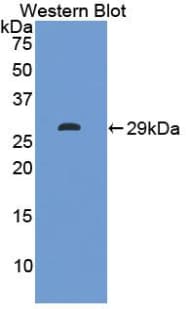 ITLN1 / Omentin Antibody (aa31-253)