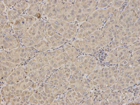 FXN / Frataxin Antibody