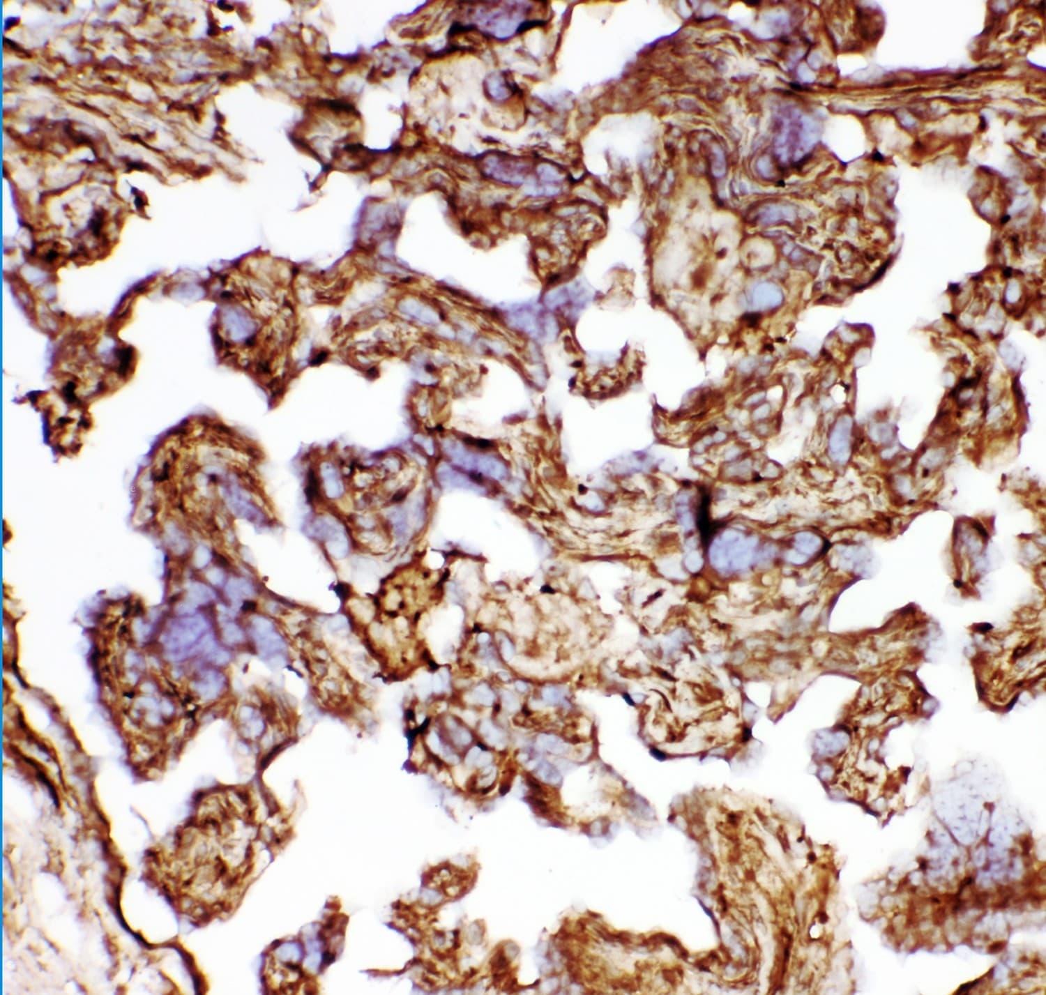 HSPB1 / HSP27 Antibody (aa1-205)