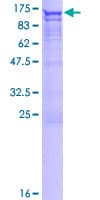 Human DAB2 Protein (Recombinant GST)