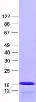 Human PRY2 Protein (Recombinant His, N-Terminal)