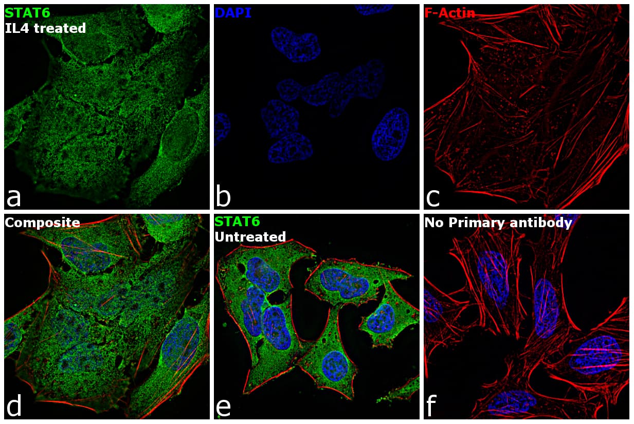 STAT6 Antibody (clone 7D3)
