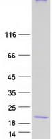 Human MAL Protein (Recombinant Myc-DDK (Flag))