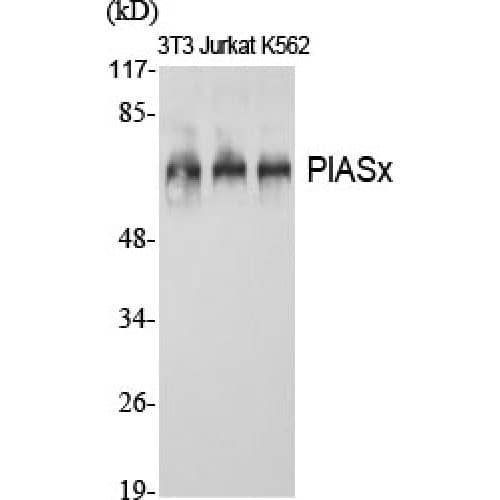 PIAS2 / PIASX Antibody (10-90 aa, N-terminal)