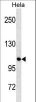 ULK1 Antibody (aa296-322)