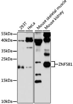 Polyclonal Rabbit anti-Human ZNF581 Antibody (IHC, WB)