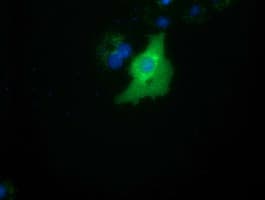 SMAD2 Antibody (clone OTI2C10)