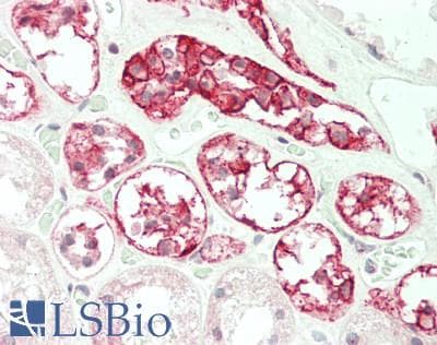 IHC-plus™ CA12 / Carbonic Anhydrase XII Antibody (aa224-273)