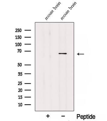 TDRKH Antibody