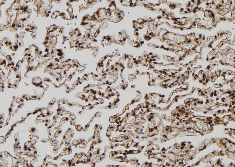 MAGEA8 Antibody
