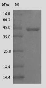 E. coli glcC Protein (Recombinant 6His-SUMO, N-terminus)