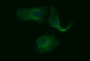 TUBB2B / Tubulin Beta 2B Antibody (clone OTI0C3)