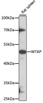 Polyclonal Rabbit anti-Human WTAP Antibody (WB)
