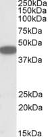 IHC-plus™ Polyclonal Goat anti-Human CXCR6 Antibody (aa321-333, IHC, WB)