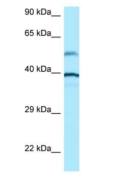 Polyclonal Rabbit anti-Human TUBA1A / Tubulin Alpha 1a Antibody (aa128-177, WB)