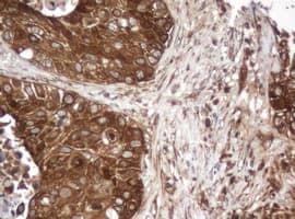 PAI-RBP1 / SERBP1 Antibody (clone OTI4G2)