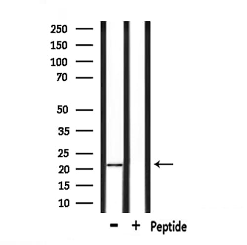 GPX4 / MCSP Antibody