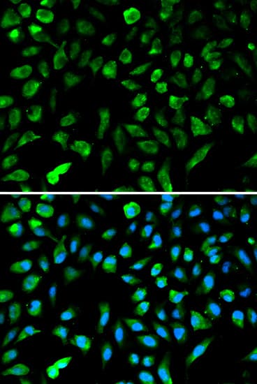 NME1 / NM23 Antibody