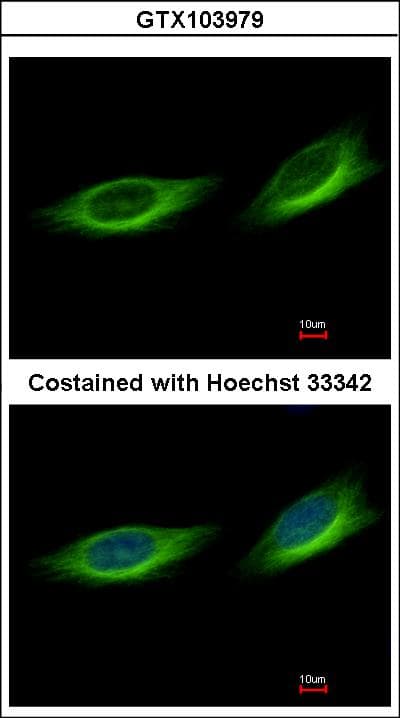 Polyclonal Rabbit anti-Human TULP1 Antibody (aa281-542, IHC, WB)