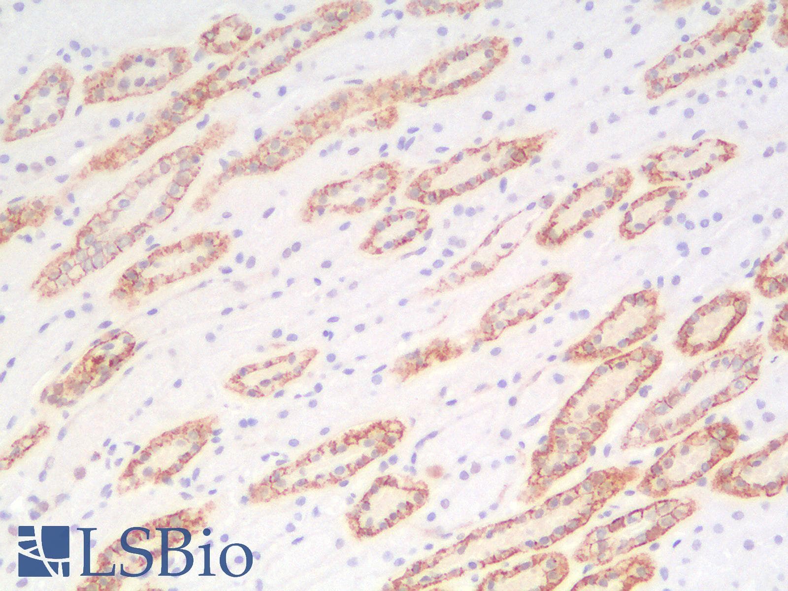 PathPlus™ CDH1 / E Cadherin Antibody (clone rCDH1/1525)