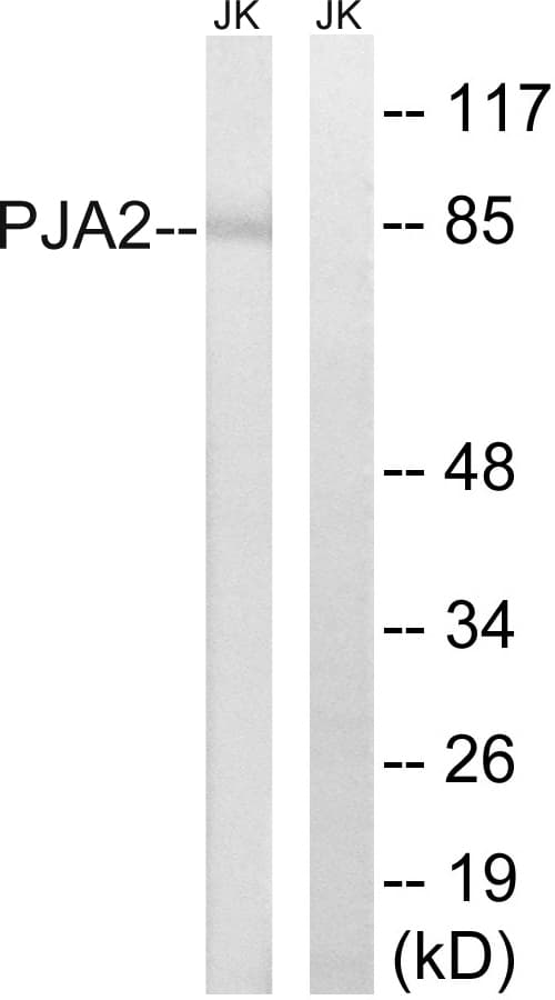 IHC-plus™ Polyclonal Rabbit anti-Human PJA2 Antibody (aa141-190, IHC, WB)