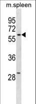 Polyclonal Rabbit anti-Human ZWILCH Antibody (aa482-508, WB)