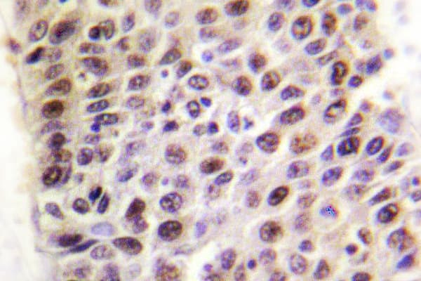KAT5 / TIP60 Antibody (Gly82)