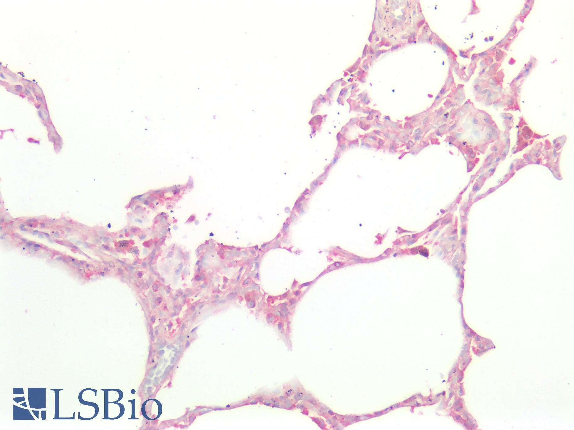 IHC-plus™ ICAM-1 / CD54 Antibody