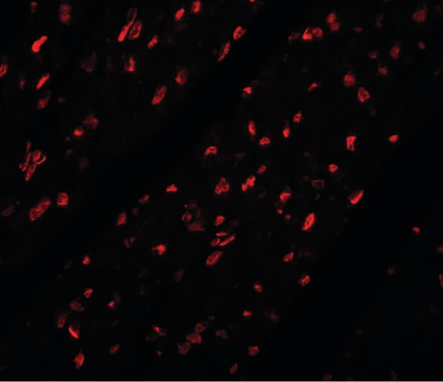 IHC-plus™ Polyclonal Rabbit anti-Human MINA / MINA53 Antibody (IHC, IF, WB)