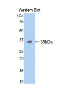 TFF3 / Trefoil Factor 3 Antibody (aa23-81)