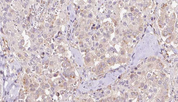 DHCR24 / Seladin-1 Antibody