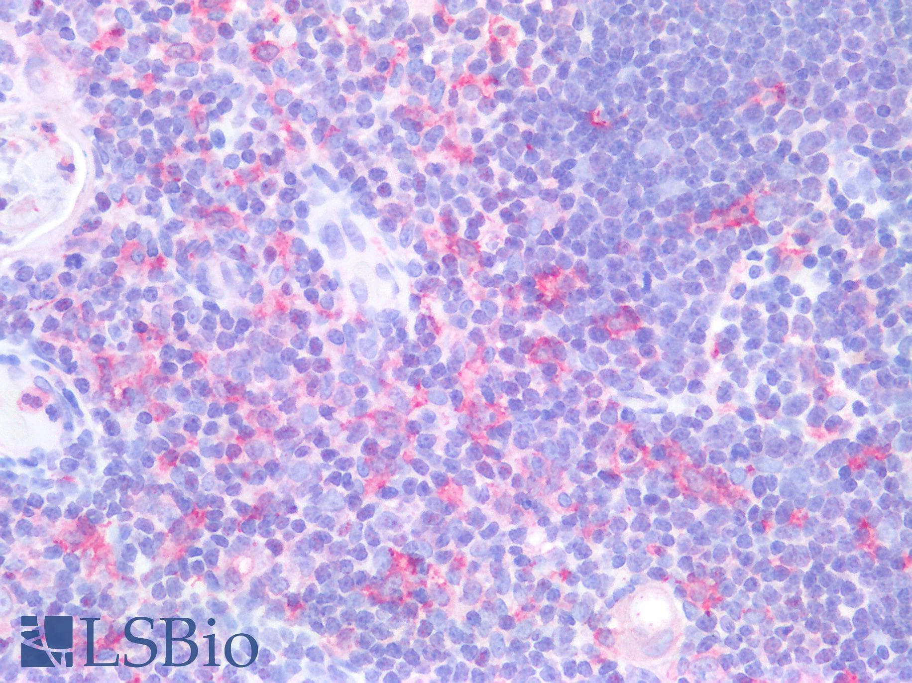 PathPlus™ AIF1 / IBA1 Antibody