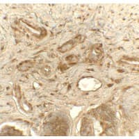 PDI / P4HB Antibody