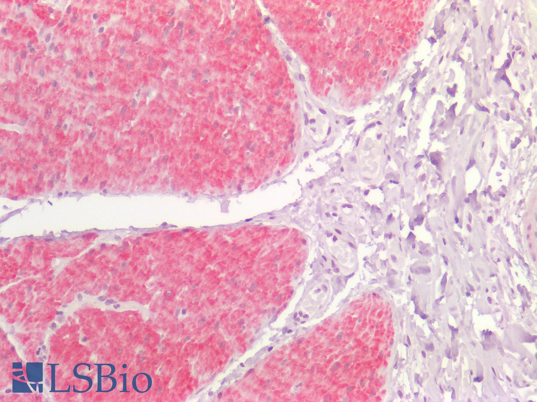 PathPlus™ Smoothelin Antibody (clone R4A)