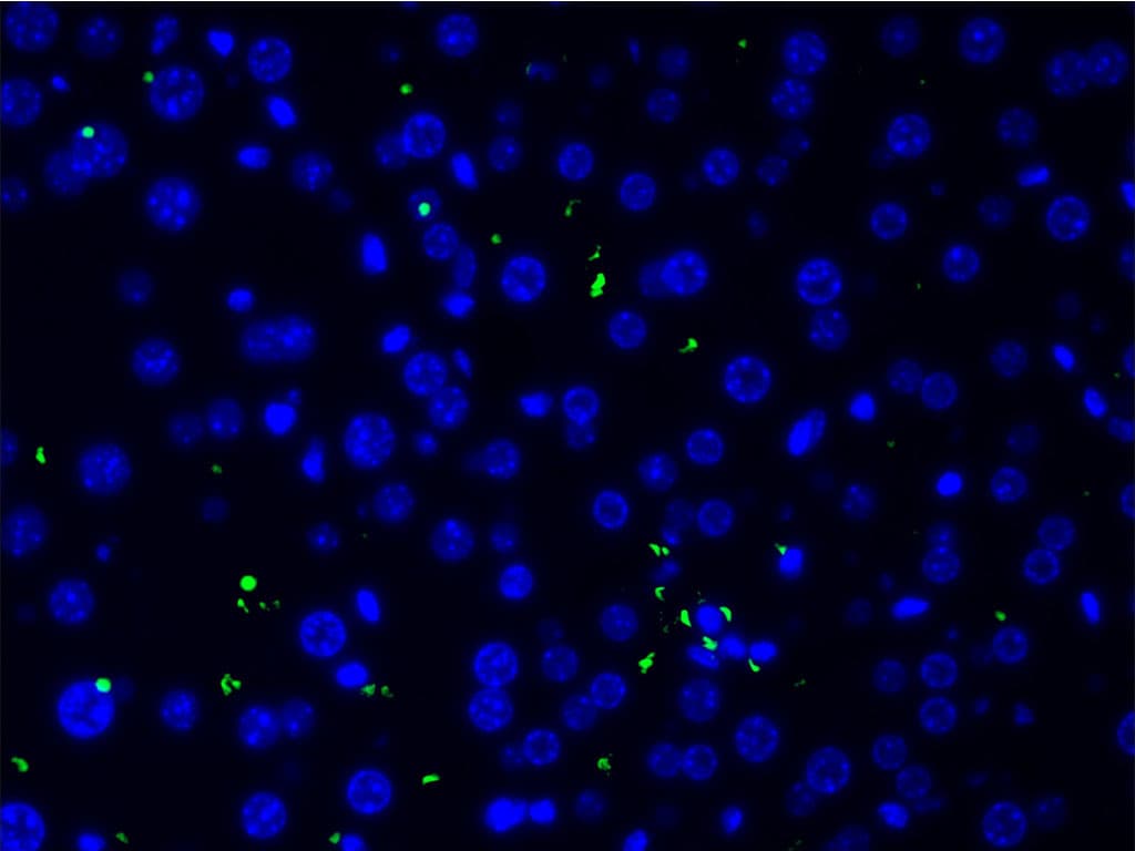 Polyclonal Rabbit anti-Human COL2A1 / Collagen II Alpha 1 Antibody (IHC, IF, WB)