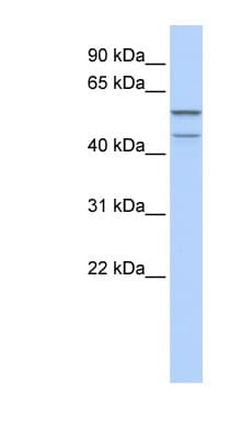 Polyclonal Rabbit anti-Human ZNF474 Antibody (aa35-84, WB)