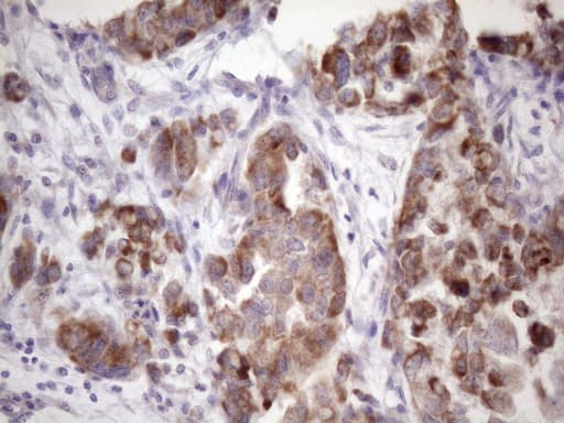 Monoclonal Mouse anti-Human DJ858B16.2 / PISD Antibody (clone OTI3B11, aa80-340, IHC, WB)