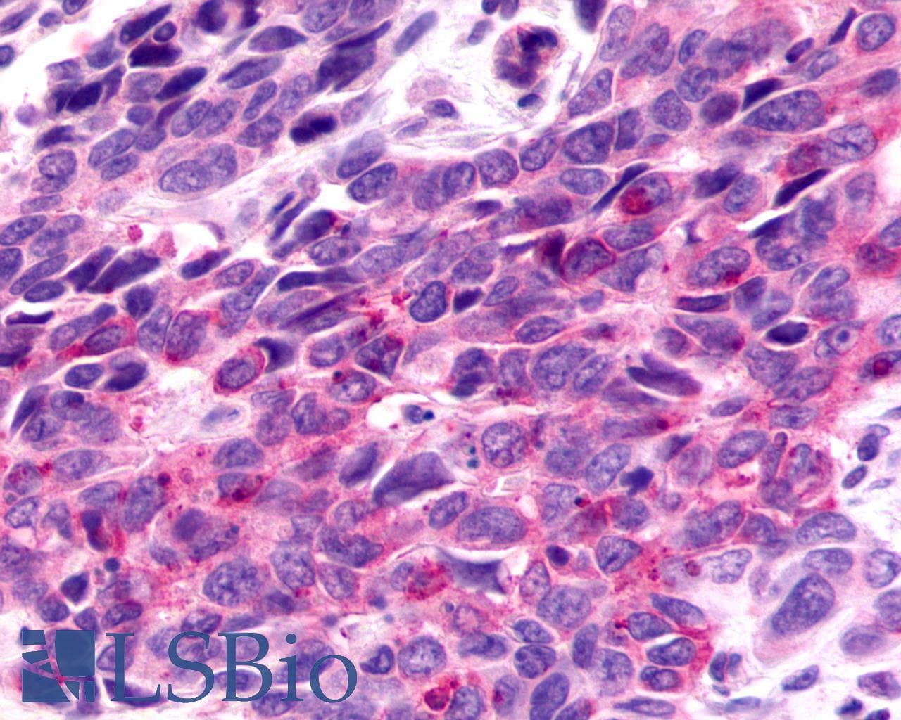 PathPlus™ F2RL3 / PAR4 Antibody (Cytoplasmic Domain)