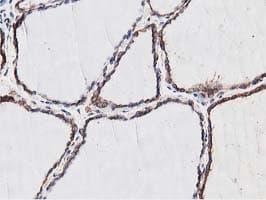 NUDT6 Antibody (clone OTI9D12)