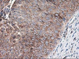RPN1 / Ribophorin I Antibody (clone OTI3E1, Carrier-free)