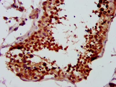 Polyclonal Rabbit anti-Human LYAR Antibody (IHC, WB)