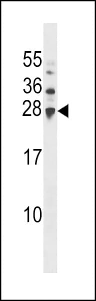 Polyclonal Rabbit anti-Human UBCH / UBE2H Antibody (aa42-70, WB)