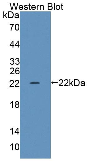 TRERF1 Antibody (aa785-942)