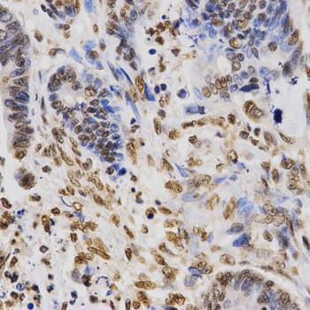 Polyclonal Rabbit anti-Human Histone H3 Antibody (Tri-Methyl-Lys36, IHC, IF, WB)