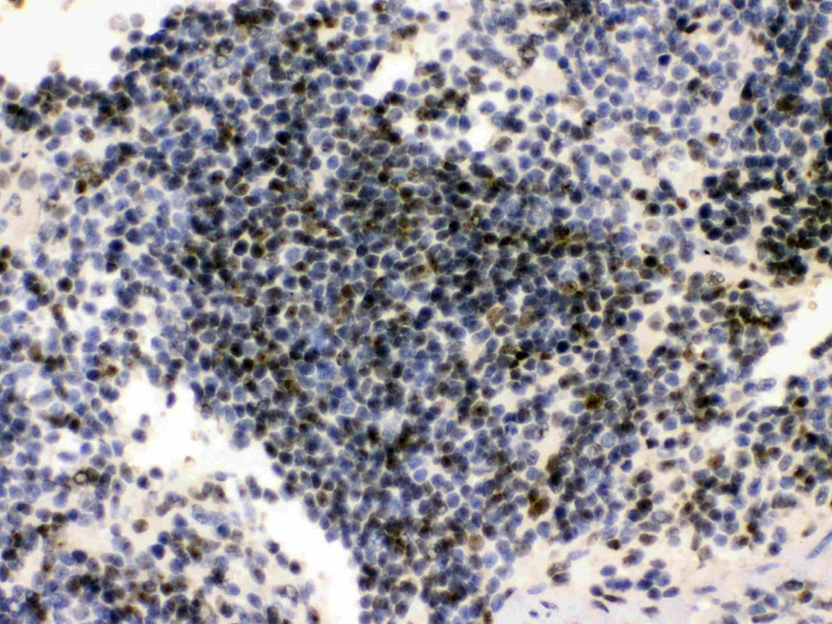 PML Antibody